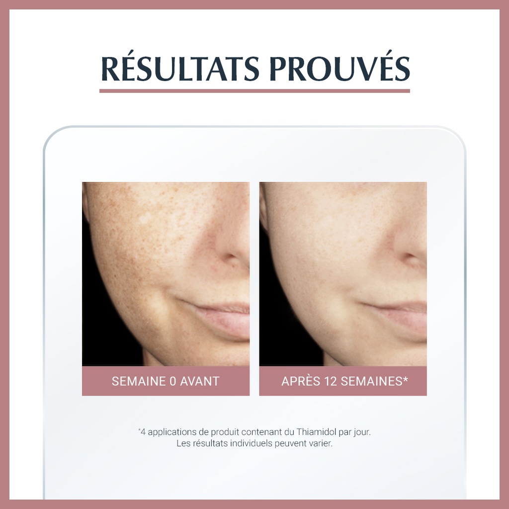 EUCERIN ANTI-PIGMENT Sérum Éclat
